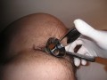 jogo-de-fetiche-exames-fisicos-de-prostata-massagem-small-2
